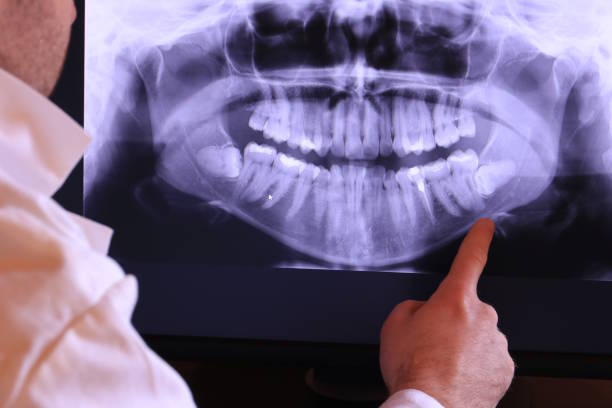 Best After-Hours Emergency Dentist in Longtown, OK